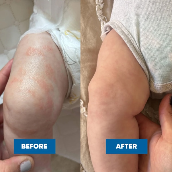 MooGoo Pink Eczema Cream - Image 2